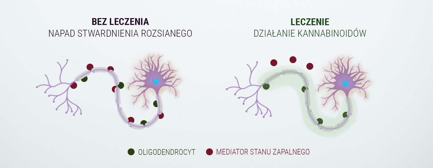Medyczna Marihuana Przy Stwardnieniu Rozsianym Czy Moze Pomoc Rqs Blog